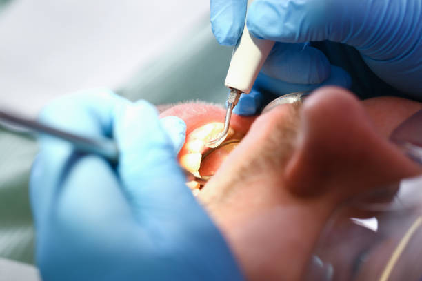 Best Emergency Root Canal Treatment in Central Park, WA