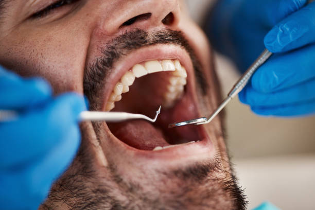 Best Emergency Dental Care for Trauma or Injury in Central Park, WA