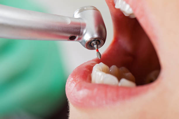 Best After-Hours Emergency Dentist in Central Park, WA